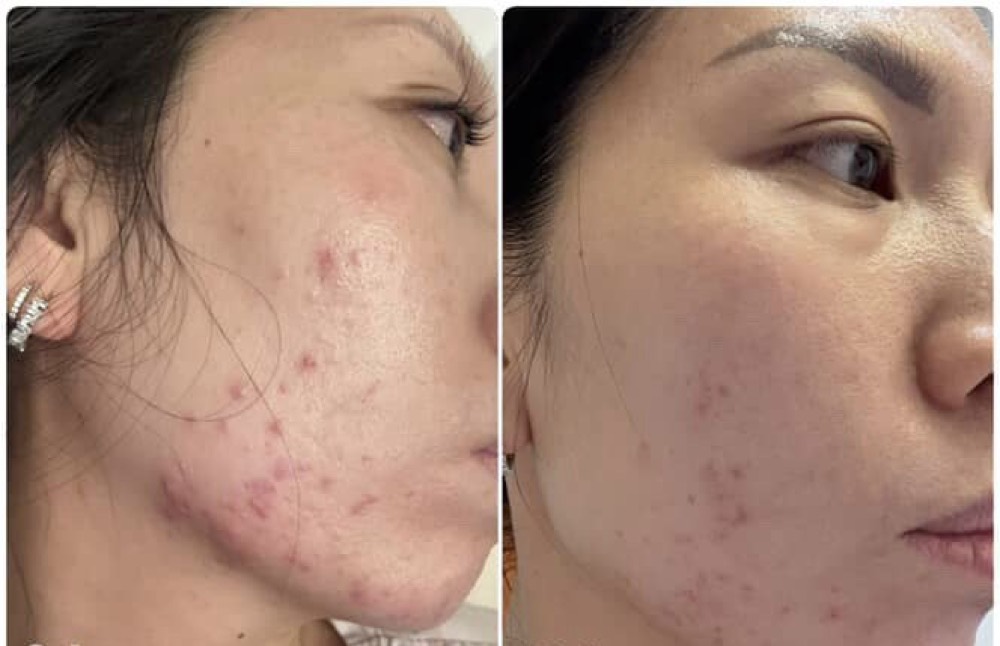 Customer photo update shared with consent